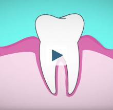 Illustration of a tooth