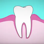 Illustration of a tooth